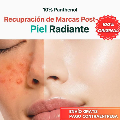 Purito Seul™ - Crema Korena tratamiento Post Acné