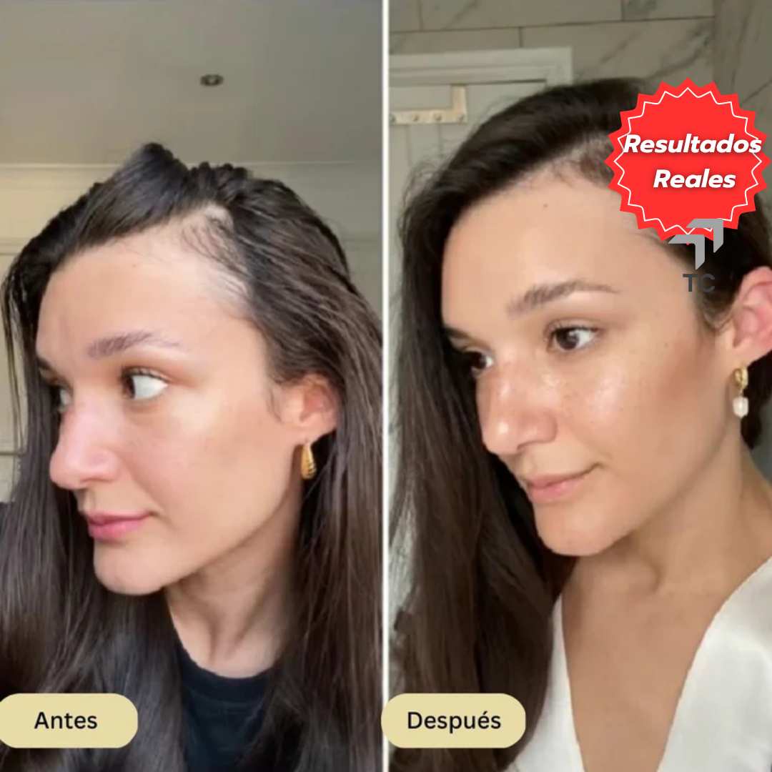 2x1 Veganic™ - Aceite natural para el crecimiento del cabello