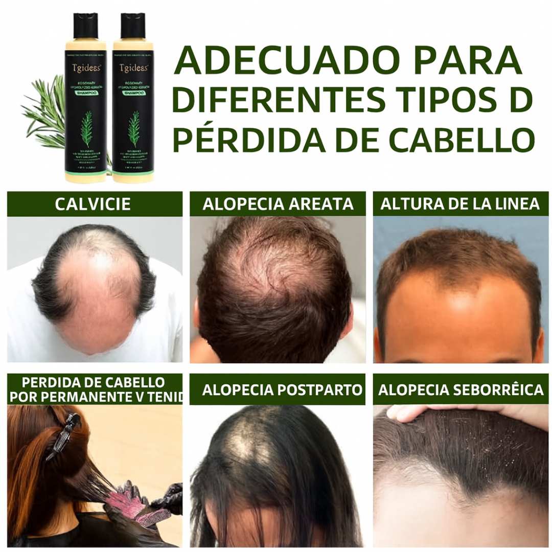 Champú Tgideas Profesional – Repara, Fortalece y Engrosa desde la Raíz